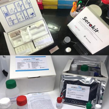 Investigadores/as del CONICET, Instituto Leloir y Laboratorio Lemos desarrollan un método que agiliza las muestras en testeos serológicos