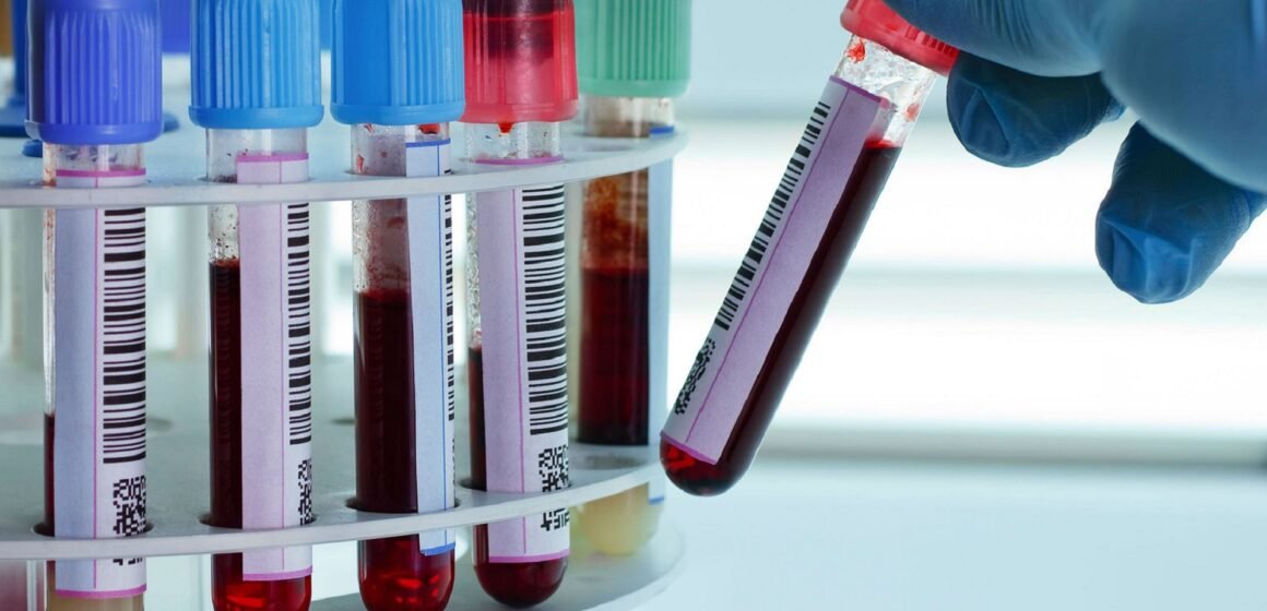 Covid -19: estudios cientificos indican que existe relación entre el tipo de sangre y la propensión al contagio